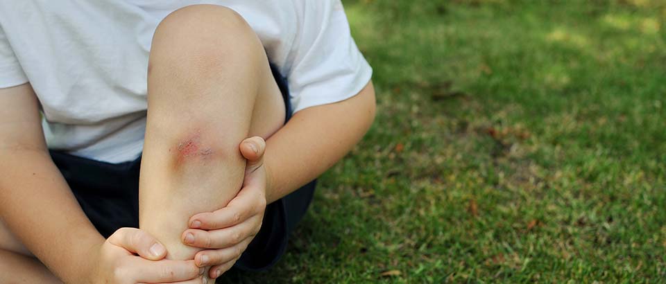 little boy holding his scraped up knee