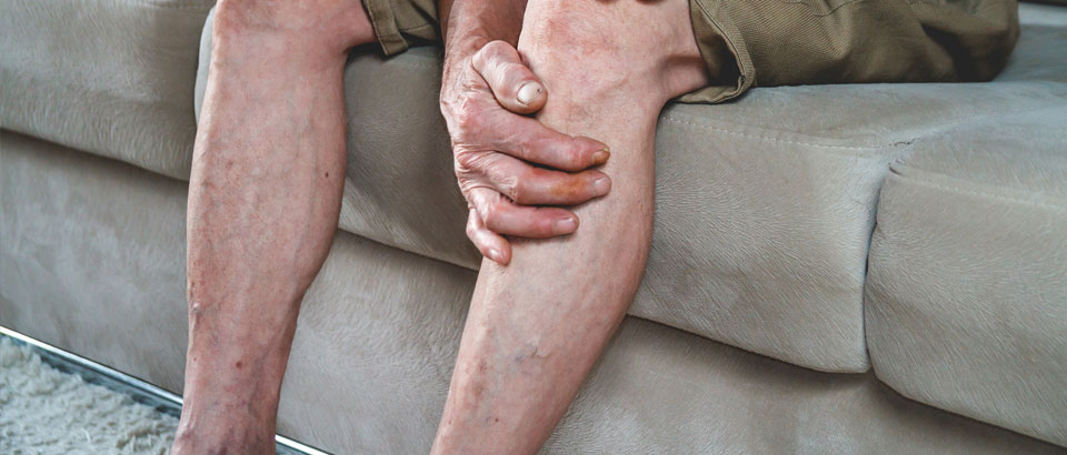 legs of man with veins